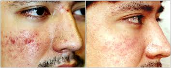 Alex — VILLANI MEDICAL