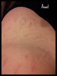 Bio oil is the skincare remedy you see in high street shops and supermarkets all the time. Bio Oil Two Girls One Mag