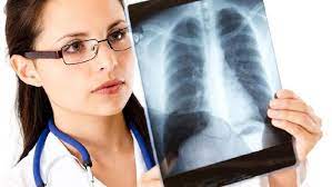 Paru paru berair / kronis. Pneumonia Vs Paru Paru Basah Sama Atau Beda Ini Kata Dokter