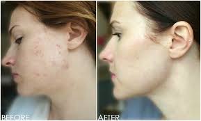 Ask The Expert — THE BEAUTY SNOOP — THE BEAUTY SNOOP