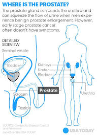 Or, the cause of a symptom may. Pennsylvania Gov Has Treatable Form Of Prostate Cancer