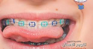 مركز الطبيب للتجميل حياكم عروض العودة الي المدارس عرض ال دينار ليزر ازالة شعر الوجه دينار ليزر ازالة شعر منطقة البكيني دينار ليزر ازا Bahrain Months