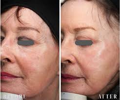 Dr Rekha Tailor's best treatments for over 60's