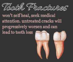 Dentaltown Where The Dental Community Lives Dental Facts Dental Emergency Dental Health Care