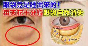 消除眼袋的方法 natural remedies remedies nature