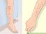 Brazilian Laser Hair Brazilian Hair Removal Before And After