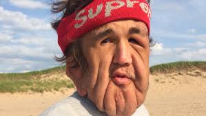 Fundraiser by Christopher Dismatsek : Help Support Nick's Facial Surgery