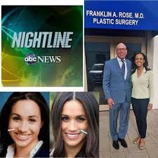 Sneak Peek Linsey Davis Of Abc S Nightline Came To Houston To Interview Celebrity Pla Meghan Markle Plastic Surgery Plastic Surgery Celebrity Plastic Surgery
