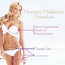 It varies from woman to woman, but the typical pattern is to have a tummy tightening (what's often called a tummy tuck) as well as some kind of breast procedure. Mommy Makeover Baltimore Plastic Surgeon Near Me Maryland