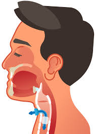 Image result for Reflux Laryngitis