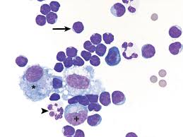 Use the menu below to choose the introduction section to get started. Effusion Cytology Clinician S Brief