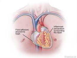 Image result for Pericardium