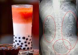 Bubble tea is especially popular in taiwan, although it is enjoyed throughout the world. Les Billes De Tapioca A Consommer Avec Moderation