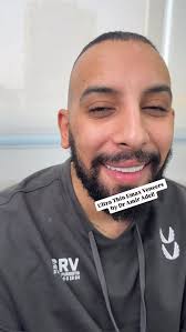 Ultra Thin Emax Veneers by Dr Amir Adel!, To book an appointment call  📞01032886787, Location 📍: Hegaz Street