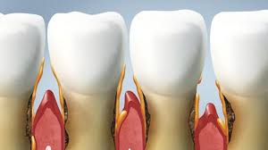 Epingle Sur Trucs Et Astuces