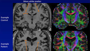 Image result for Fatigue Diagnostic Testing