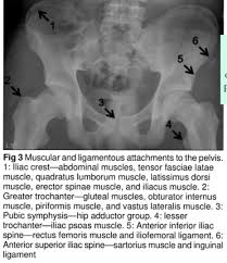 Image result for Hip Apophysitis
