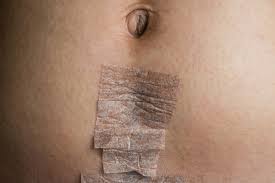 Despite how common the procedure has become, c . How Many C Sections Can You Have Parents