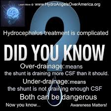 Pin On Hydrocephalus