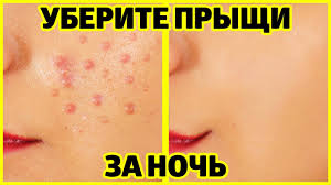 как быстро отбелить лицо от загара в домашних условиях Kak Otbelit Kozhu Lica Za 10 Minut V Domashnih Usloviyah Youtube