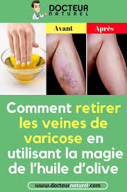 Epingle Sur تخسيس الوزن