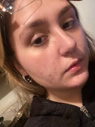 Wide Angle Distortion