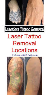 Be sure to carefully follow all aftercare instructions your doctor gives you, and don't be afraid to ask for clarification if you have. How Much Does It Cost To Remove A Tattoo Laser Tattoo Removal In My Area How Long Did It Take To Remove Your T Tattoo Removal Cost Tattoos Tattoo Removal Cream