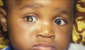 How to be the friend a cancer family needs; A Mobile Phone Image Reveals That A Child Has Cancer Teller Report