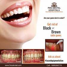 Pin By Fatiha Mmaslouh On Dentiste Gum Treatment Dental Dental Hospital