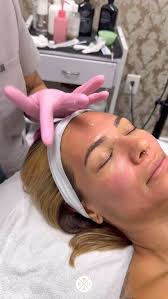 ✨ Microneedling + Exosomes = Skin Regeneration Powerhouse ✨, If you’re  looking to take your microneedling results to the next level, exosomes are  your skin’s new secret weapon. These powerful, ...