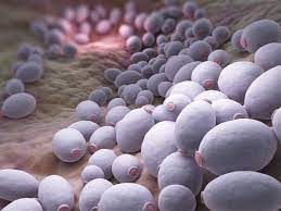 Darm Candida Ursachen Symptome Behandlung Und Ernahrung Mirko Colombo Health Coach Pontresina Lugano Poschiavo Zurigo