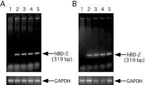 The organism salmonella enteritidis , a common cause of gastroenteritis (a form of food poisoning), has been found to be transferred through the hen ovary in fewer than 1 percent of all eggs produced. Salmonella Enteritidis Flic Flagella Filament Protein Induces Human B Defensin 2 Mrna Production By Caco 2 Cells Journal Of Biological Chemistry