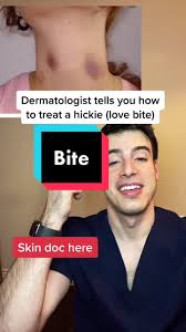 Cara hilangkan perut buncit perempuan. Treating A Hickie More Skin Tips In My Book And On Ig Love Hickie Lovebites Fy Fyp Viral Skincarehack Lifehack Needtoknow Tiktokpartner