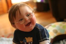 Precious Down Syndrome Cute Baby Pictures Beautiful Children