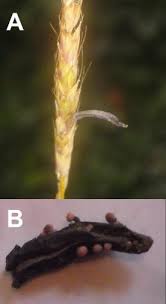 Image result for Ergotism