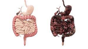 Ob blut im stuhl einer medizinischen behandlung, muss im einzelfall entschieden werden. Was Ist Morbus Crohn Ursachen Symptome Behandlung Krank De