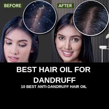 When used regularly, this formula will rejuvenate hair follicles and improve. Best Hair Oil For Dandruff Best Anti Dandruff Oil Vitsupp