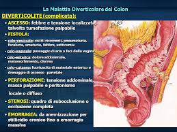 1 la malattia diverticolare evidenziata alla colon tac. Malattia Diverticolare Ppt Video Online Scaricare