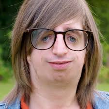 I Was Born Without Ears Or Cheekbones