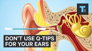 3 Ways To Remove Earwax With No Q Tips Super Clean Works Really Well Healthy Tips Network Ear Wax Ear Wax Buildup Cleaning Your Ears