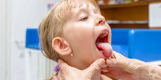 What You Need to Know About Tonsillitis