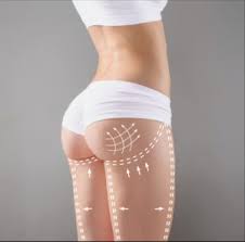 Prix et infos lipofilling visage,chirurgie greffe graisse pour rajeunissement visage,comblement rides,volume zones de creux visage. Lipofilling Mammaire Prix Avant Apres Avis Ledabelle
