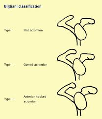 The acromion is a small section of the scapula which extends anteriorly from the spine of the scapula and the acromial angle (aa) is a prominent bony point at the junction of the lateral border of the. Http Bonefix Co Nz Portals 160 Files 1basic 20shoulder Pdf