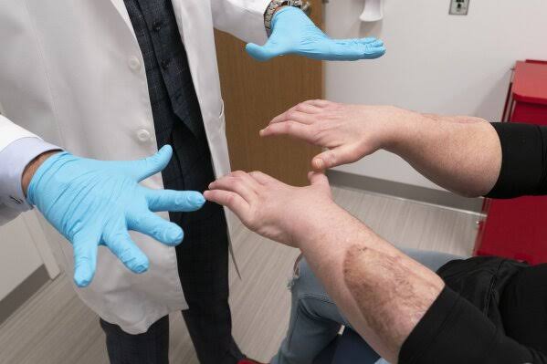 Joe DiMeo's transplanted hands during a medical follow-up, do AI tạo
