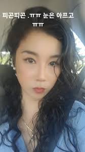 눈이 너무 아프다.나뭇가지에 찔려서 눈이 부었음.눈물은 멈췄는데 눈이 아직도 시림.