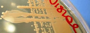 How to grow yeast cells. Guide To Making And Storing Competent Yeast Cells
