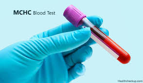 Mchc Blood Test Symptoms Causes Of Low And High Mchc