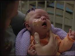 Whooping cough is caused by a bacterium called bordetella pertussis. Whooping Cough Symptoms And Treatment In Adults And In Babies