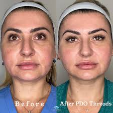 Winter Park Laser & Anti-Aging Center