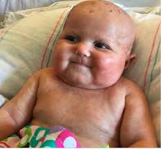 2019 CIS Annual Meeting: Immune Deficiency & Dysregulation North American  Conference